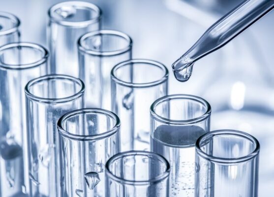 afstemming met arbeidshygiënisten